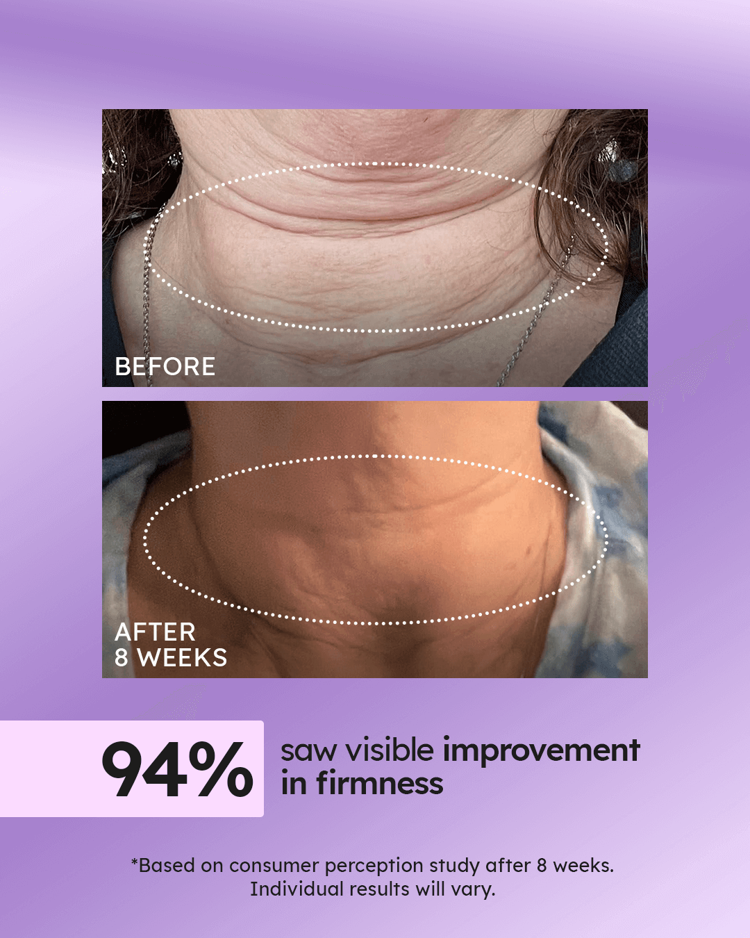 Advanced Neck Cream Best-Selling Kit