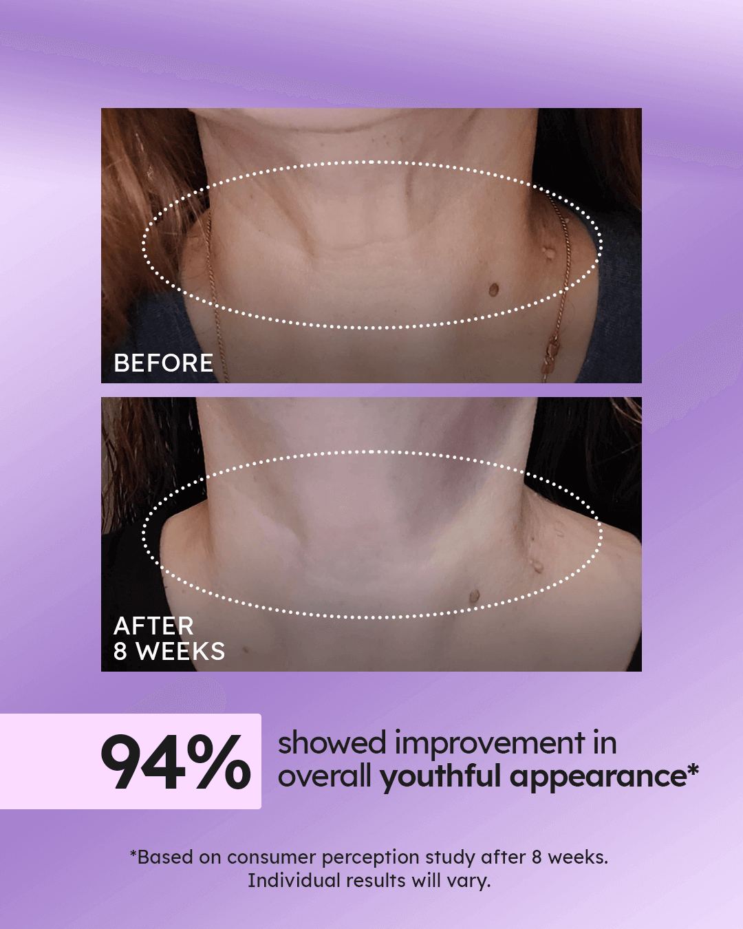 Advanced Neck Cream Best-Selling Kit