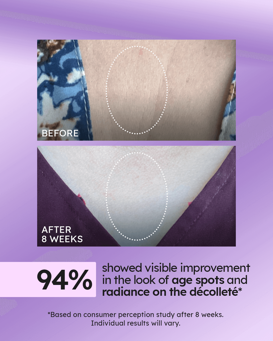 Advanced Neck Cream Best-Selling Kit