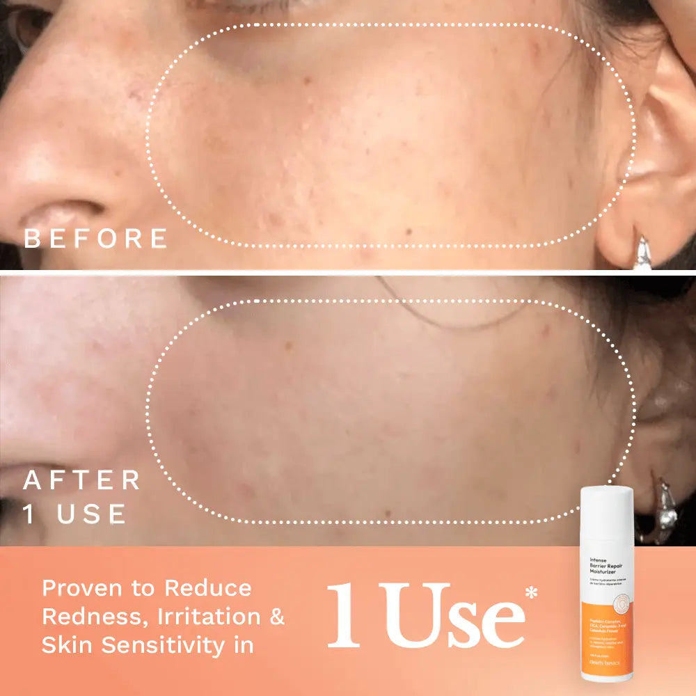 Intense Barrier Repair Moisturizer