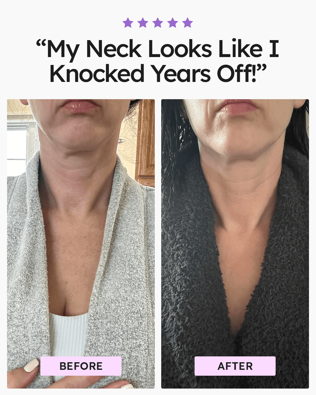 Advanced Neck Cream Best-Selling Kit