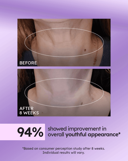 Advanced Neck Cream Best-Selling Kit