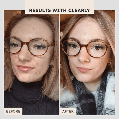 Pore Balancing Hydroxy Cleanser - Clearly Basics