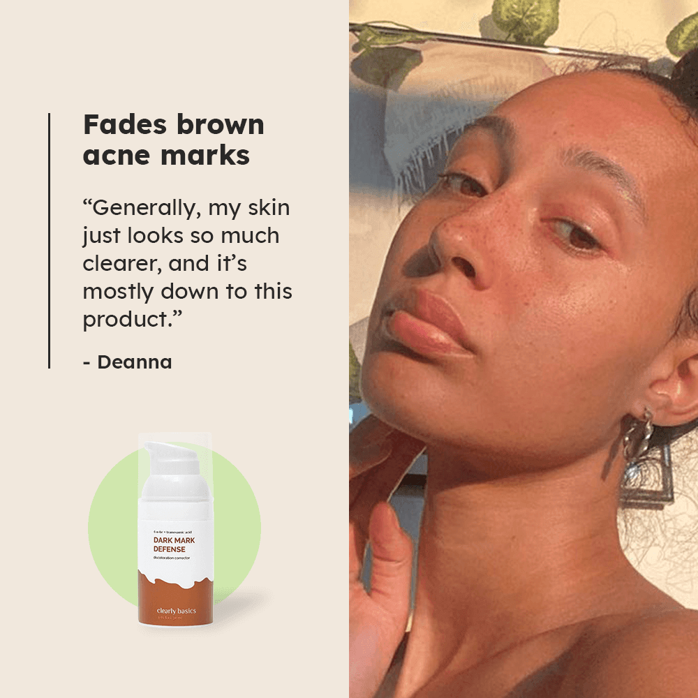 Dark Mark Defense Correction Gel - Clearly Basics