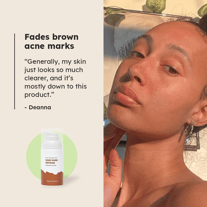 Dark Mark Defense Correction Gel - Clearly Basics