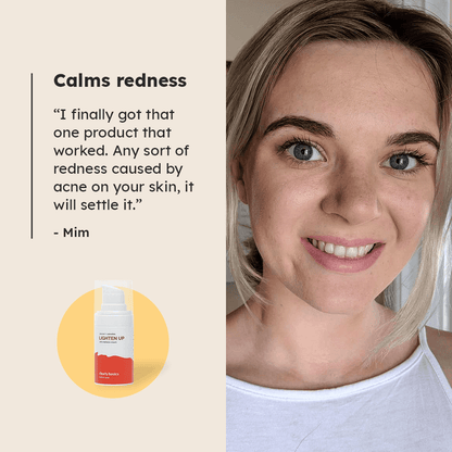 Lighten Up Redness Rescue Cream - Clearly Basics