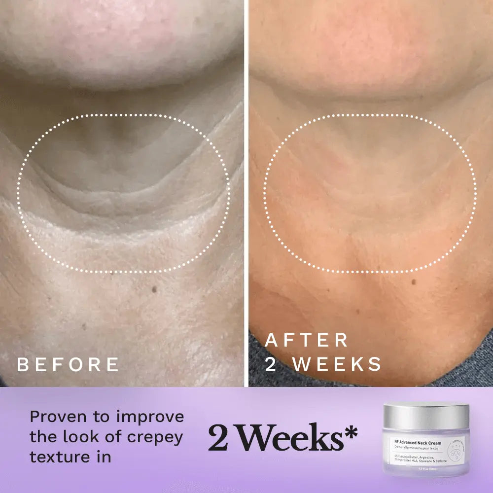 NF Advanced Tightening Neck Cream
