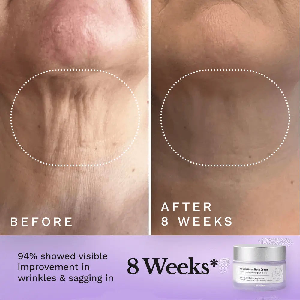NF Advanced Tightening Neck Cream