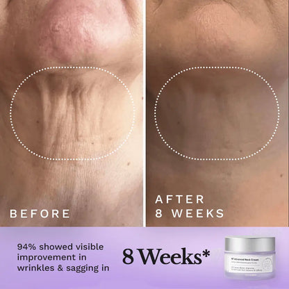 NF Advanced Neck Cream