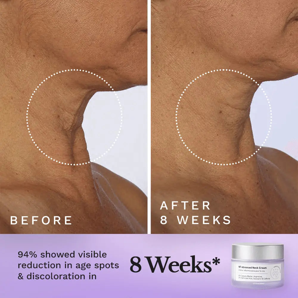 NF Advanced Tightening Neck Cream