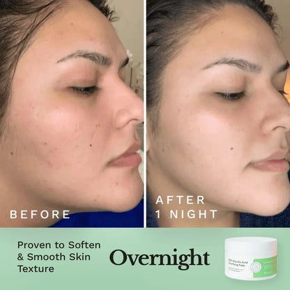 Glycolic Resurfacing Peel Pads