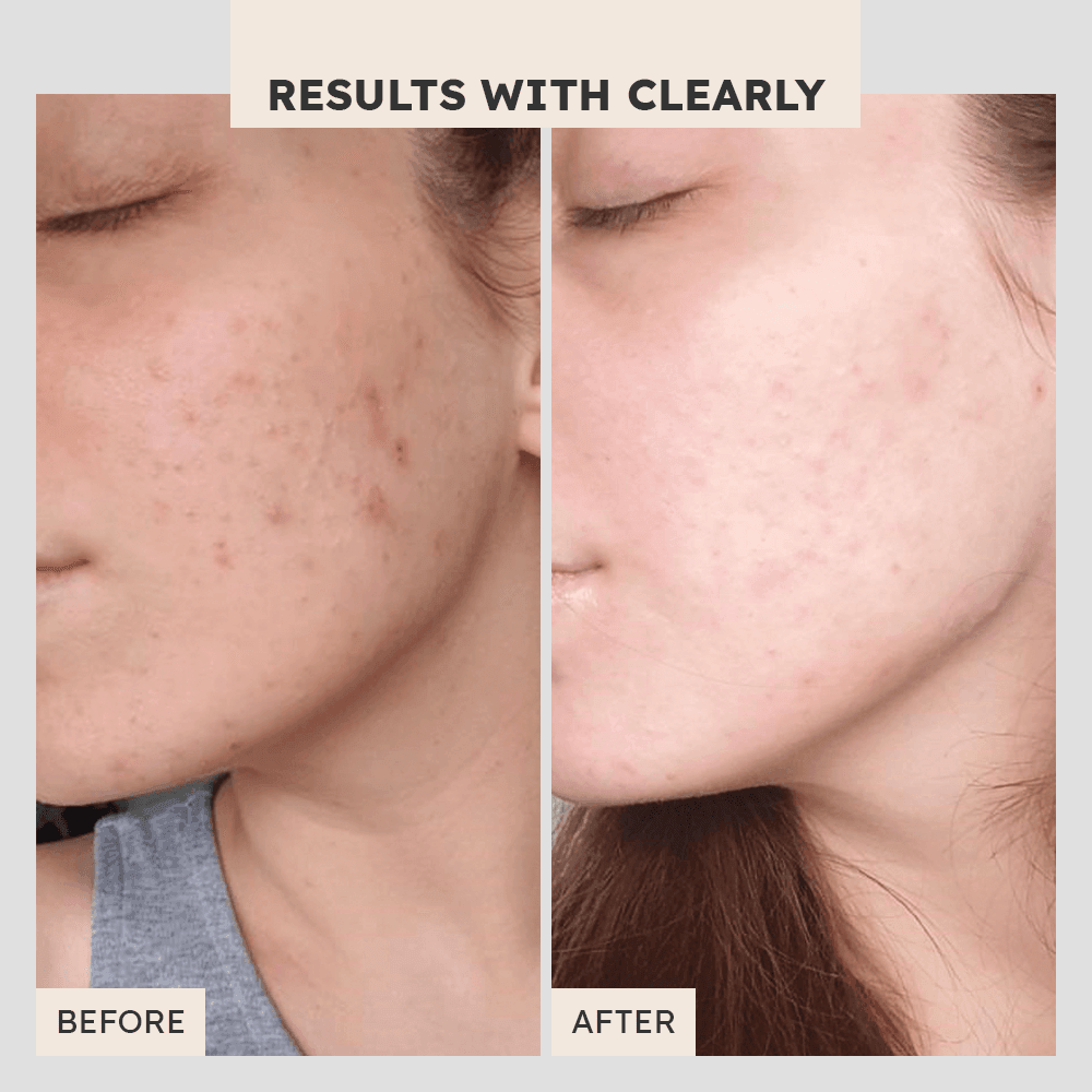 Protective Peptide Moisturizer - Clearly Basics