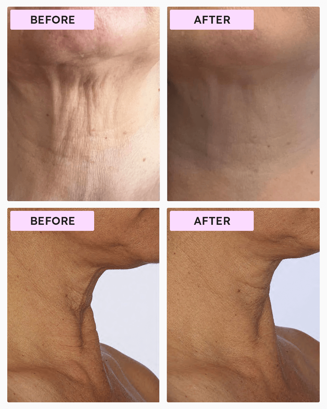 NF Advanced Tighten & Lift Neck Cream