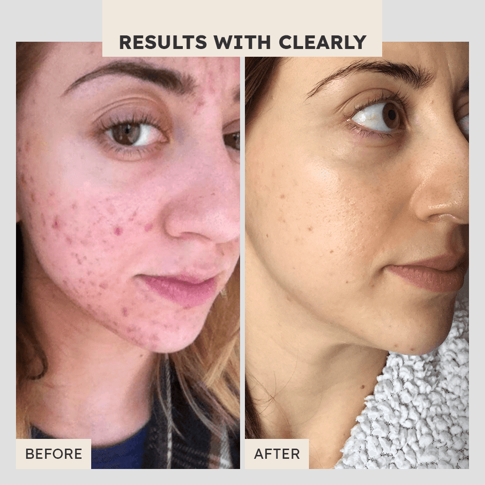 SH+ Matte Hydrating Serum - Clearly Basics